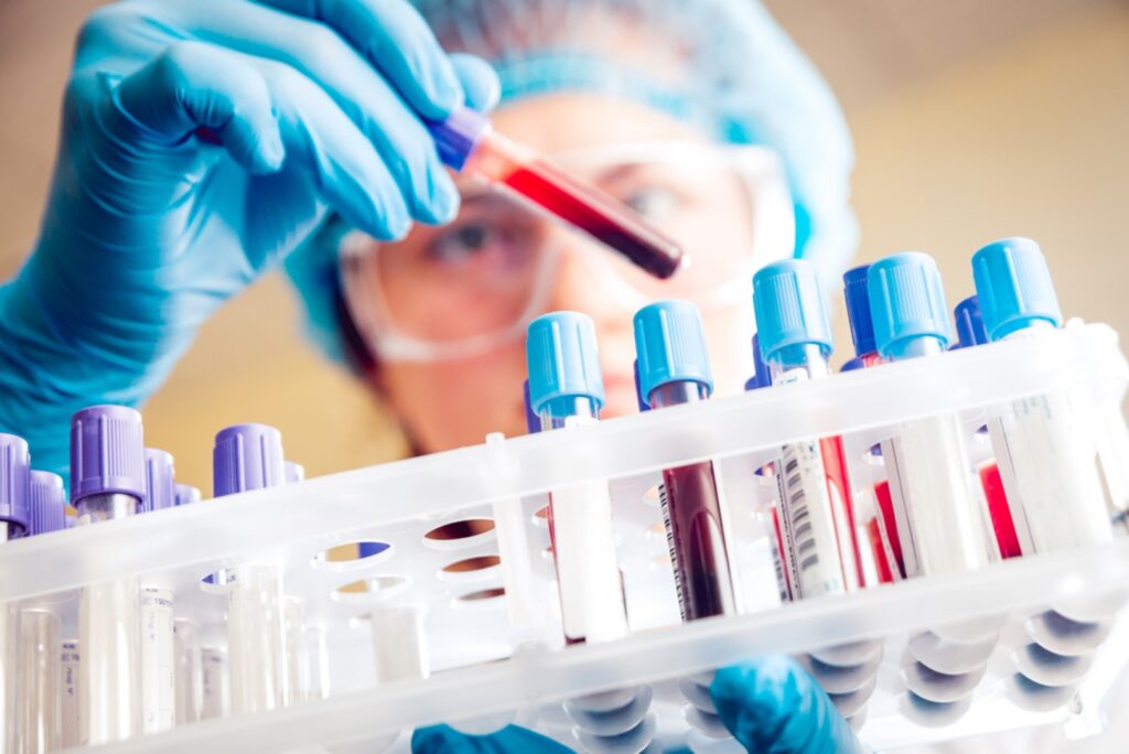 family practice near me, medical testing center Atlanta GA, x-rays Atlanta GA, types of medical tests, blood test