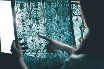 doctor-examines-brain-scans
